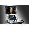 Стаціонарний УЗД апарат високого класу Mindray DC-40, фото 7