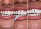Блеск для зубів Hismile Glostik Tooth Gloss, фото 4