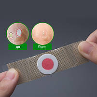 Пластир для видалення мозолів, сухих мозолів та натоптишів 1 пластина 6 шт, фото 5