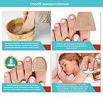 Пластырь-наклейки для коррекции вросшего ногтя Nail Patches в упаковке 16 шт, фото 2