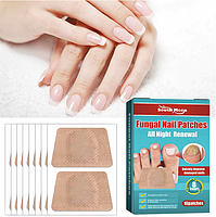 Пластырь-наклейки для коррекции вросшего ногтя Nail Patches в упаковке 16 шт, фото 8