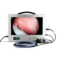 Система медичної ендоскопічної відеокамери NCM-FHD 180 Full HD для ендоскопічної хірургії