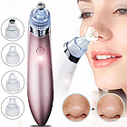 Вакуумний апарат для чищення пор 4 насадки, USB, Beauty Skin Care Specialist XN-8030/ Дефузний очисник пор, фото 8