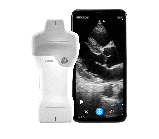 Ультрапортативна УЗД сиситема Vscan Air™SL, фото 6