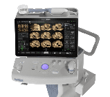 Ультразвуковий апарат (УЗД) Voluson™ SWIFT, фото 3