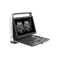 Портативна система ультразвукова діагностична Zoncare М70