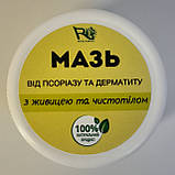 Мазь від псоріазу та дерматиту, фото 6