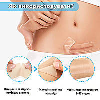 Силіконовий пластир від шрамів і рубців після операцій, кесаревого, опіках, водостійкий, гіпоалергенний 4×150 см, фото 3