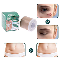 Силіконовий пластир від шрамів і рубців після операцій, кесаревого, опіках, водостійкий, гіпоалергенний 4×150 см, фото 5