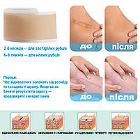 Силіконовий пластир від шрамів і рубців після операцій, кесаревого, опіках, водостійкий, гіпоалергенний 4×150 см, фото 9