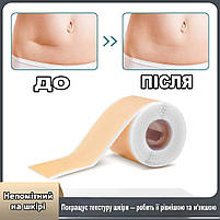 Силіконовий пластир від шрамів і рубців після операцій, кесаревого, опіках, водостійкий, гіпоалергенний 4×150 см, фото 8