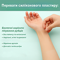 Силіконовий пластир від шрамів і рубців після операцій, кесаревого, опіках, водостійкий, гіпоалергенний 4×150 см, фото 10