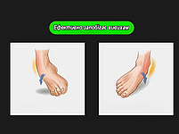 Еластичний фіксатор-бандаж на гомілковостопний суглоб з ременем, для спорту, реабілітації, захисту суглоба, чорний, фото 5