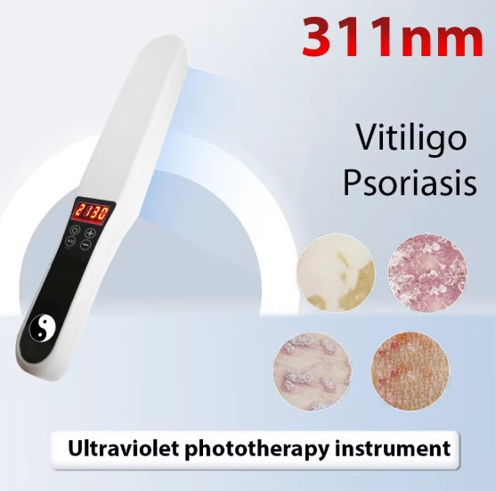 Дермалайт UV450 UVB-311 nm для лікування захворювань шкіри, з вбудованим таймером, без гребеня, фото 1