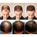 Олійка для росту волосся 35мл LUNOON / Олія для шкіри голови / Олія від випадіння волосся, фото 2