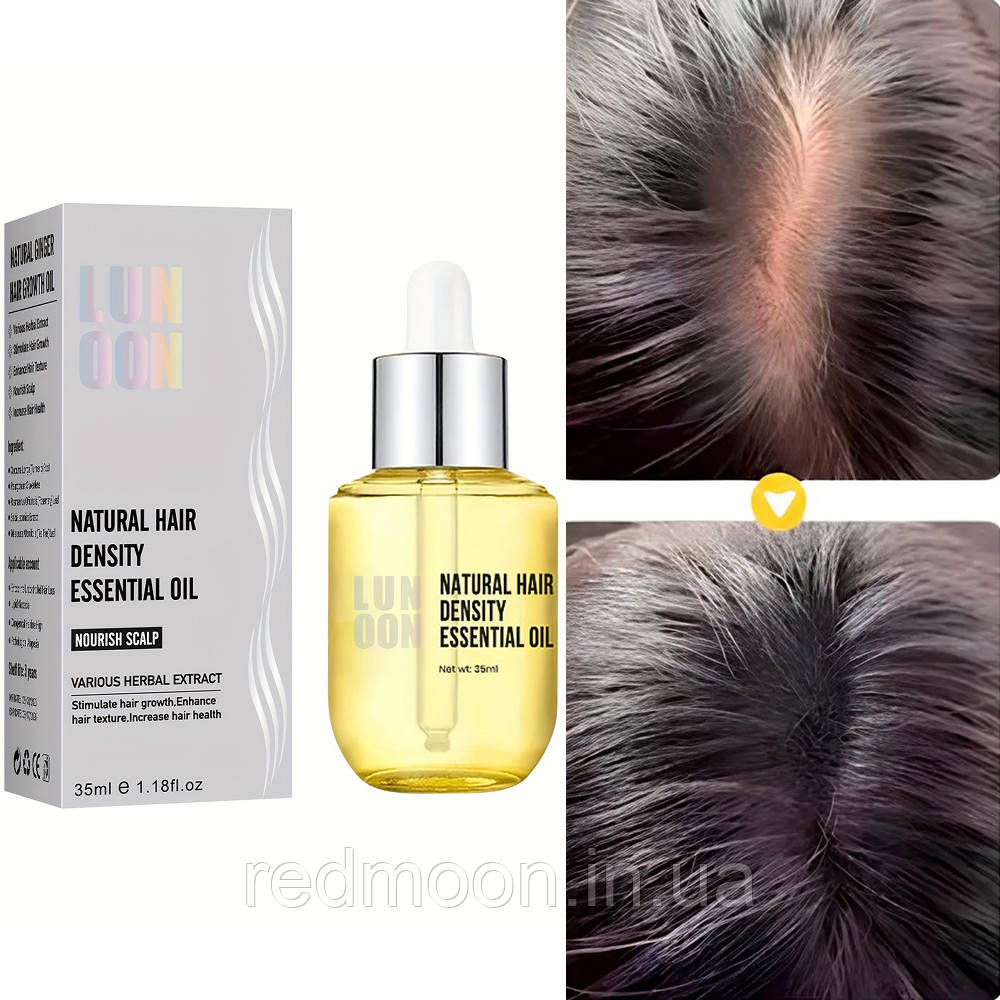Олійка для росту волосся 35мл LUNOON / Олія для шкіри голови / Олія від випадіння волосся, фото 1