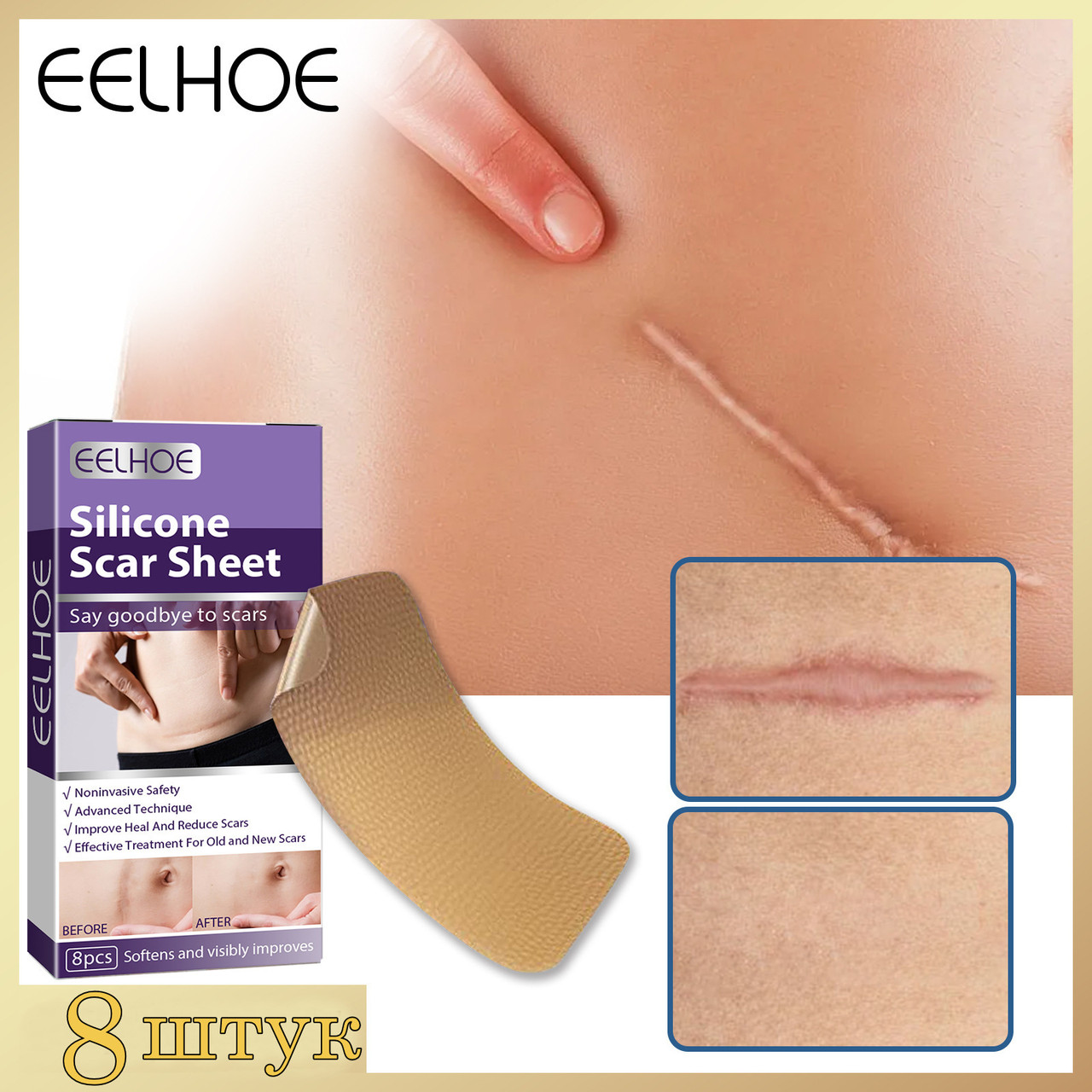 Силіконовий пластир від шрамів та рубців EELHOE Silicone Scar Sheet 8 штук, фото 1
