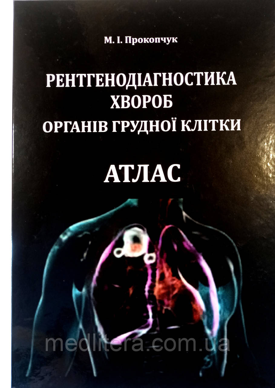 Прокопчук РЕНТГЕНОДІАГНОСТИКА ХВОРОБ ОРГАНІВ ГРУДНОЇ КЛІТКИ АТЛАС 2025 рік, фото 1