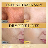 Крем від зморшок з бджолиною отрутою Sadoer bee venom (50 гр)(Прим`ята упаковка!), фото 5