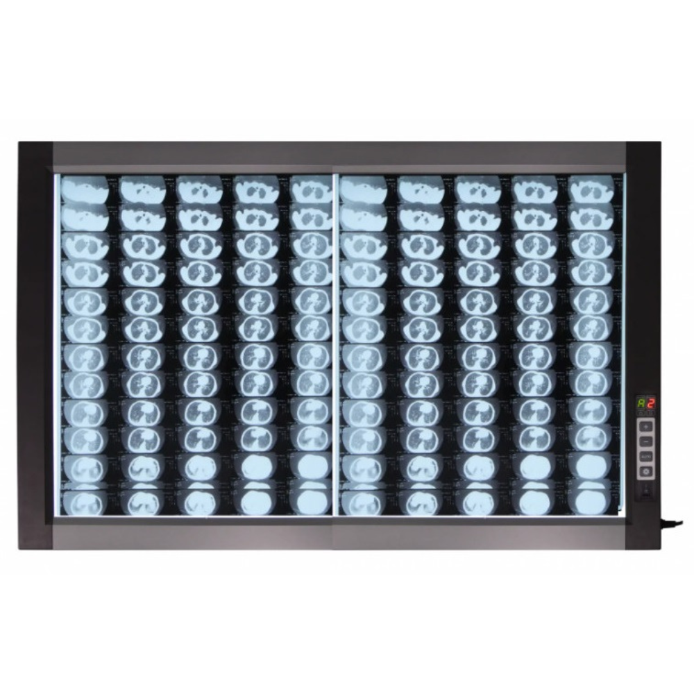 Світлодіодний медичний негатоскоп WL-2D, фото 1