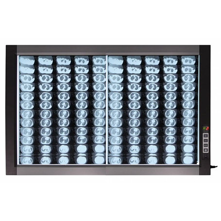 Негатоскопи