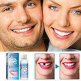 Клей для тимчасового ремонту зубів і фіксації протезів у гранулах 30 мл Стоматологічний термопластичний гель, фото 5