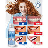 Клей для тимчасового ремонту зубів і фіксації протезів у гранулах 30 мл Стоматологічний термопластичний гель, фото 9