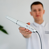 Інтраоральний 3D сканер FUSSEN S6000, фото 5