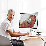 Інтраоральний сканер TRIOS 4 Wireless Pod (3Shape, Данія), фото 2