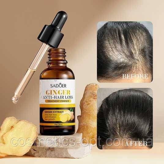 Імбирна сироватка від випадіння та для росту волосся Sadoer Ginger Anti-Hair Loss Treatment Essence, 30 мл, фото 1