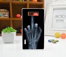 Силіконовий бампер для LG L7 p700 p705 з картинкою Рентген