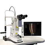 SLT/YAG комбінована лазерна система та фотокоагулятор Smart532 Digital Trio Медапаратура, фото 3