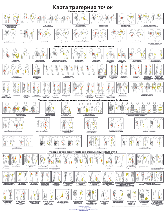 Плакат Карта Тригерних точок 86×67см Плакат з тригерними точками голови та шиї Плакат для масажного кабінету, фото 1