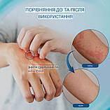 Крем проти алергії NOVOLAN протиалергічний мазь проти свербіння шкіри, укусів комах, грибкових інфекцій 20 грамів, фото 3