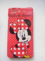 Силіконовий чохол для Doogee X5 /X5S