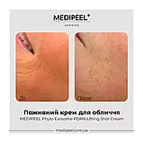 Антивіковий крем для обличчя Medi-Peel Phyto Exosome PDRN Lifting Shot , 50 ml, фото 2