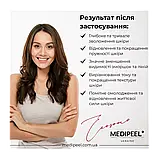 Антивіковий крем для обличчя Medi-Peel Phyto Exosome PDRN Lifting Shot , 50 ml, фото 6