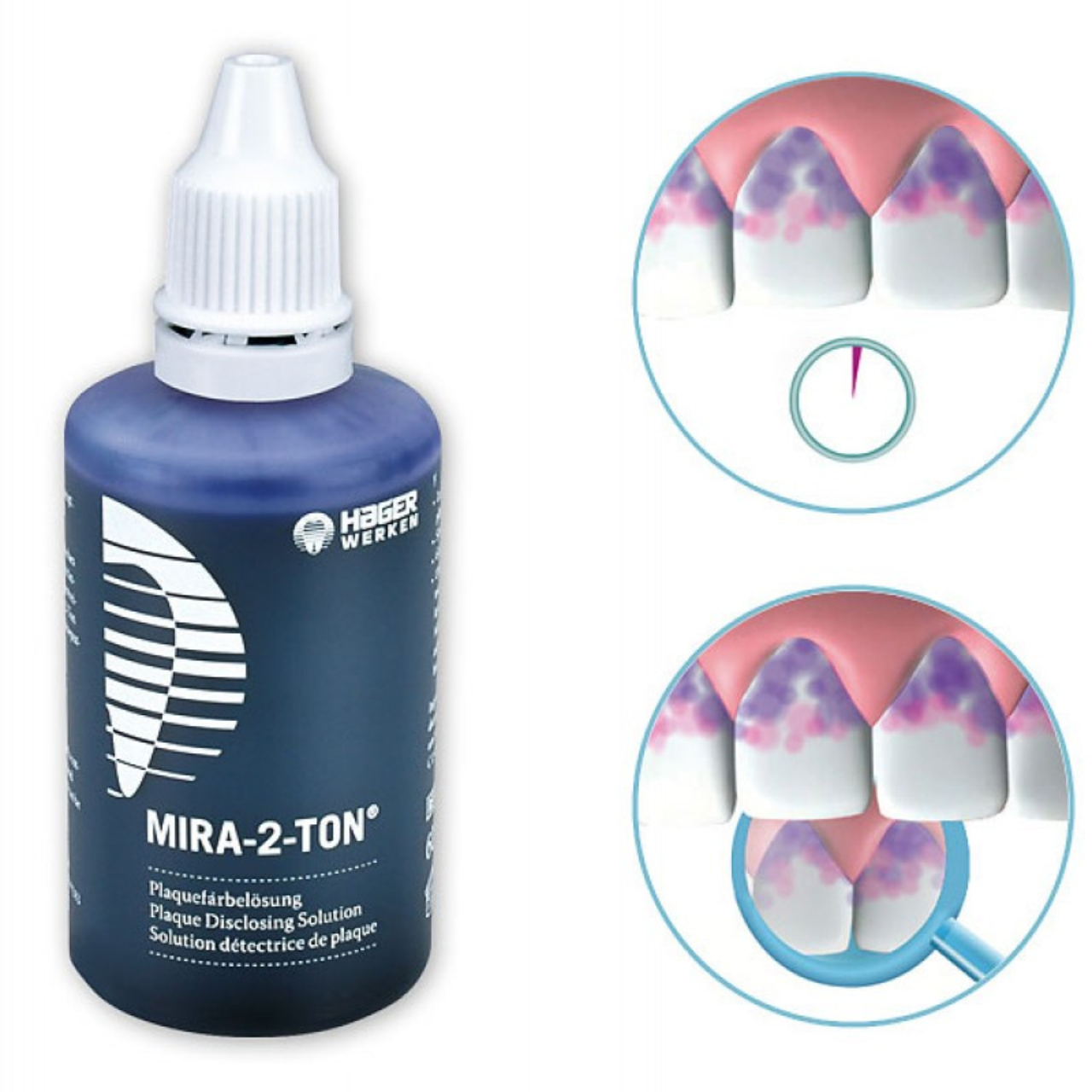 Рідина Mira-2-Ton для визначення зубного нальоту, 60 мл, Німеччина, фото 1