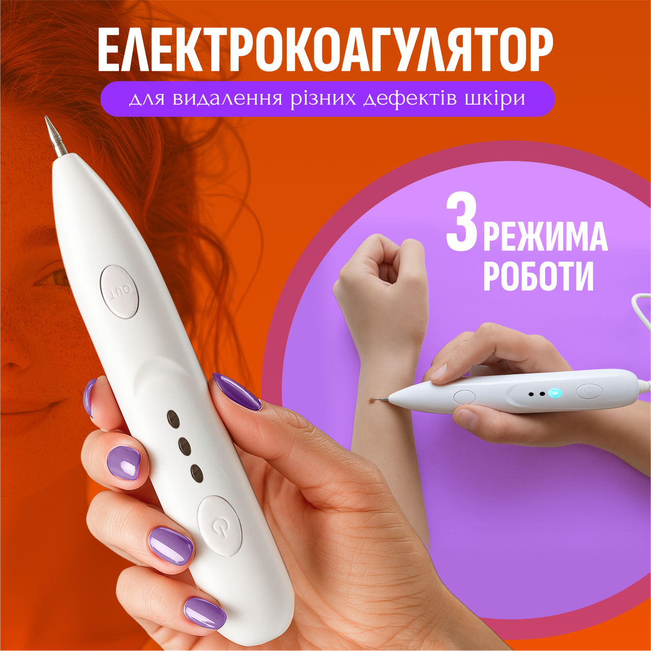 Електрокоагулятор плазмовий прилад для видалення папілом бородавок апарат (плазмова ручка) Mini Freckle, фото 1