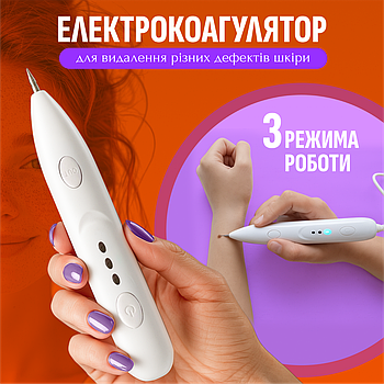 Електрокоагулятор плазмовий прилад для видалення папілом бородавок апарат (плазмова ручка) Mini Freckle