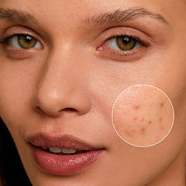 Серія для проблемної шкіри