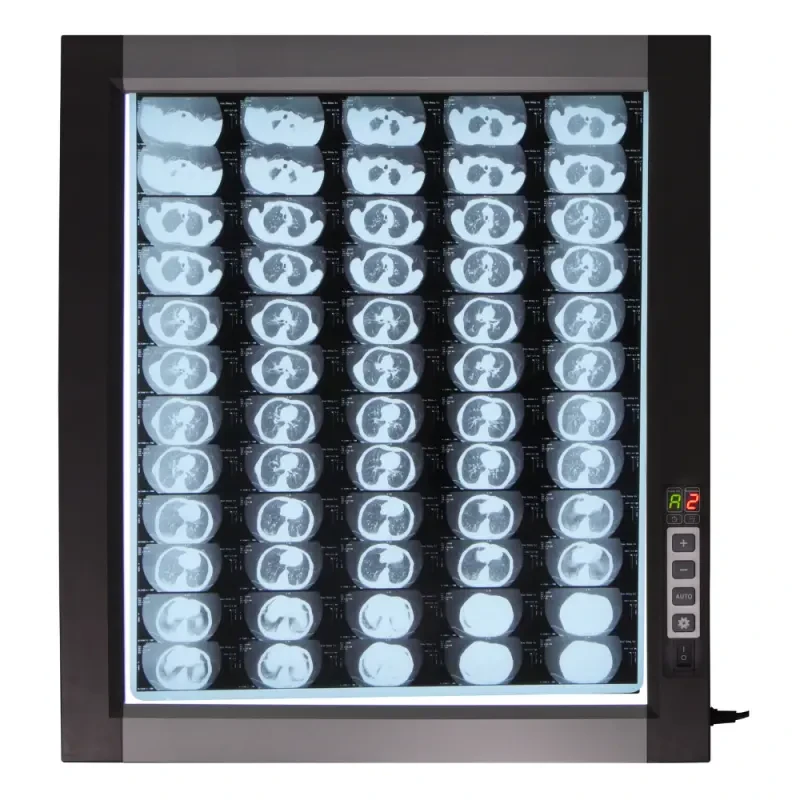 Негатоскоп світлодіодний однокадровый WL-1D