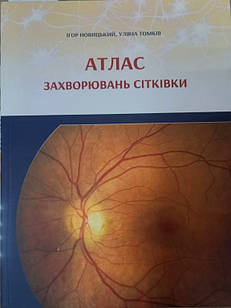 Атлас захворювань сітківки