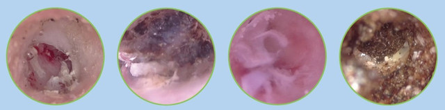 Для чого використовується отоскоп у ветеринарії?