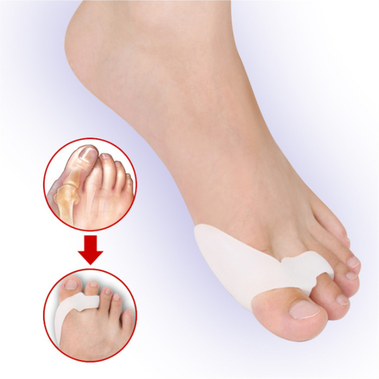Valgus Pro+ фіксатор кісточки і великого пальця - Медичний коректор Hallux Valgus