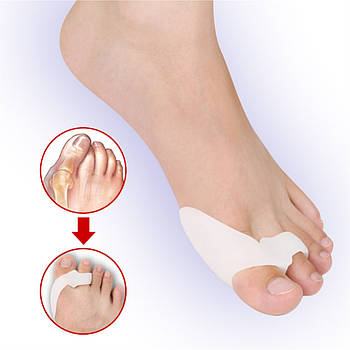 Valgus Pro + фіксатор великого пальця і кісточки - Коректор Hallux Valgus
