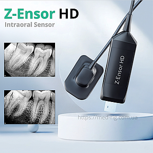 Візіографи Z-Ensor HD Радіовізіограф Візіограф Стоматологічний Візіографи Дентальні Преміум Китай 2025 рік