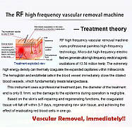 Аппарат SVS 60 Вт RF для видалення судин і зірочок, фото 3