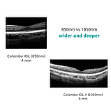 Біометр оптичний Colombo IOL II Moptim Медапаратура, фото 3
