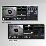 Біометр оптичний Colombo IOL II Moptim Медапаратура, фото 4